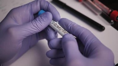 assistant holds test tube with label coronavirus over table