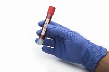 Coronavirus testi, beyaz arka planda Covid-19 izole edilmiş kan tüplü mavi eldivenler..