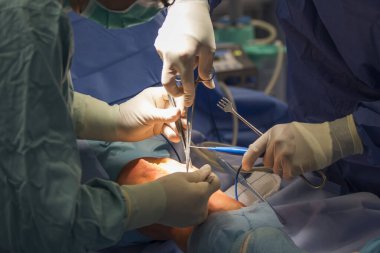 Cerrahlar diz ameliyatı yapıyor.