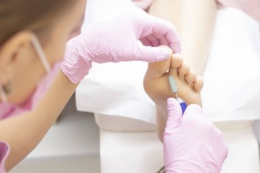 Genç bir kadın güzellik salonunda profesyonel pedikür yaptırıyor, yakın plan. Profesyonel güzellik salonu. Pedikür, manikür konsepti. Çatlamış ve ayaklarında nasırlar