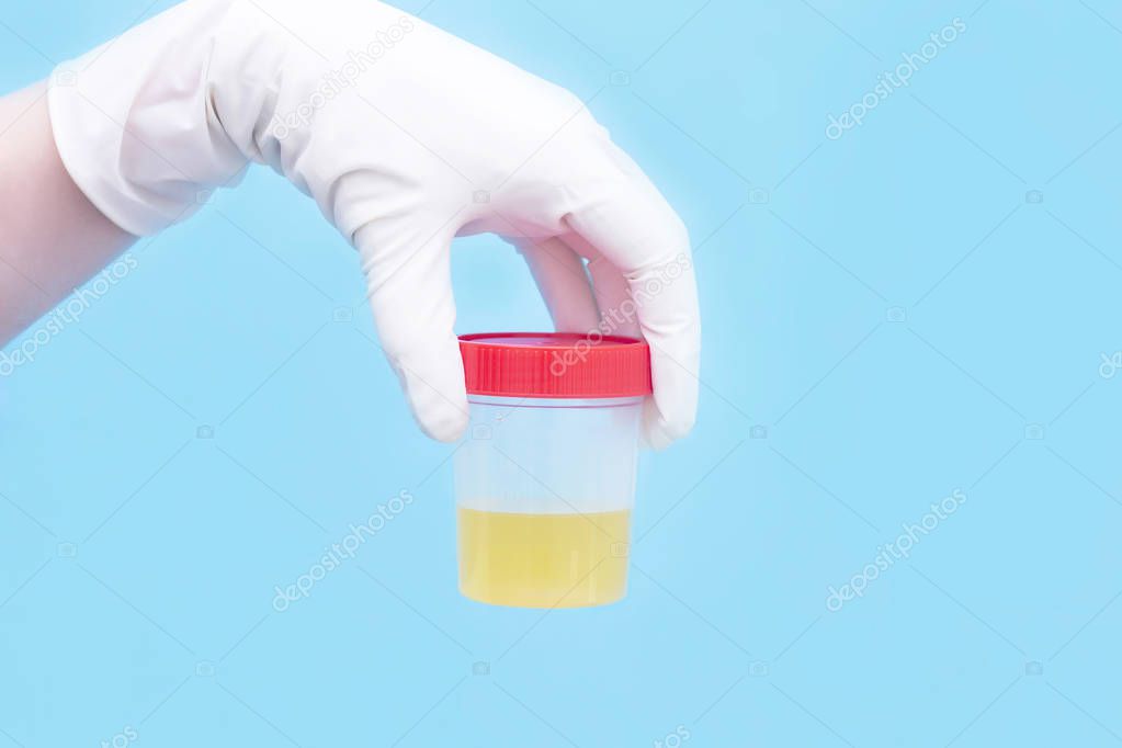 medical analysis of urine. The doctor holds in his hand a urine test in a jar with a red lid. healthcare and medicine.