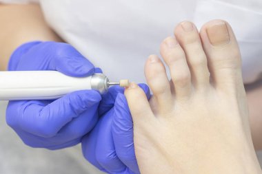 Terapi pedikürü. Usta podolojist donanım pedikürü yapıyor. Podiyatriyi ziyaret et. Kaplıcada ayak tedavisi. Podiatria Kliniği.