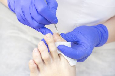 Terapi pedikürü. Usta podolojist donanım pedikürü yapıyor. Podiyatriyi ziyaret et. Kaplıcada ayak tedavisi. Podiatria Kliniği.