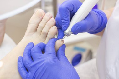 Terapi pedikürü. Usta podolojist donanım pedikürü yapıyor. Podiyatriyi ziyaret et. Kaplıcada ayak tedavisi. Podiatria Kliniği.