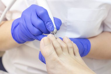 Terapi pedikürü. Usta podolojist donanım pedikürü yapıyor. Podiyatriyi ziyaret et. Kaplıcada ayak tedavisi. Podiatria Kliniği.