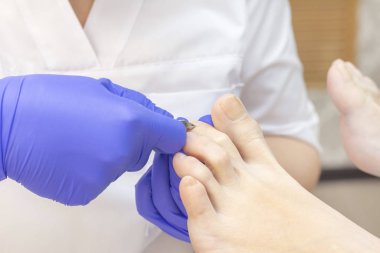 Terapi pedikürü. Usta podolojist donanım pedikürü yapıyor. Podiyatriyi ziyaret et. Kaplıcada ayak tedavisi. Podiatria Kliniği.