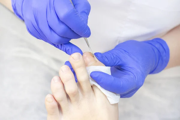Terapi pedikürü. Usta podolojist donanım pedikürü yapıyor. Podiyatriyi ziyaret et. Kaplıcada ayak tedavisi. Podiatria Kliniği.