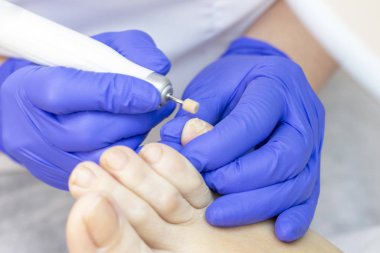 Terapi pedikürü. Usta podolojist donanım pedikürü yapıyor. Podiyatriyi ziyaret et. Kaplıcada ayak tedavisi. Podiatria Kliniği.