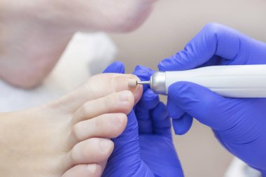 Terapi pedikürü. Usta podolojist donanım pedikürü yapıyor. Podiyatriyi ziyaret et. Kaplıcada ayak tedavisi. Podiatria Kliniği.