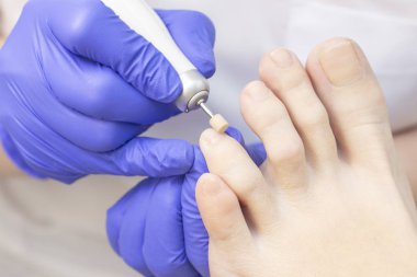 Terapi pedikürü. Usta podolojist donanım pedikürü yapıyor. Podiyatriyi ziyaret et. Kaplıcada ayak tedavisi. Podiatria Kliniği.