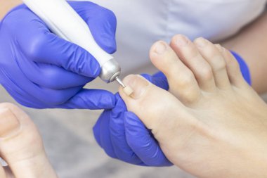 Terapi pedikürü. Usta podolojist donanım pedikürü yapıyor. Podiyatriyi ziyaret et. Kaplıcada ayak tedavisi. Podiatria Kliniği.