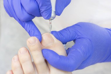 Terapi pedikürü. Usta podolojist donanım pedikürü yapıyor. Podiyatriyi ziyaret et. Kaplıcada ayak tedavisi. Podiatria Kliniği.