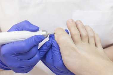 Terapi pedikürü. Usta podolojist donanım pedikürü yapıyor. Podiyatriyi ziyaret et. Kaplıcada ayak tedavisi. Podiatria Kliniği.