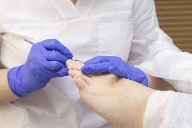 Terapi pedikürü. Usta podolojist donanım pedikürü yapıyor. Podiyatriyi ziyaret et. Kaplıcada ayak tedavisi. Podiatria Kliniği.