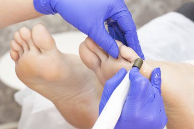 Terapi pedikürü. Usta podolojist donanım pedikürü yapıyor. Podiyatriyi ziyaret et. Kaplıcada ayak tedavisi. Podiatria Kliniği.