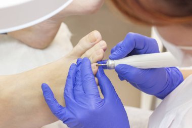 Terapi pedikürü. Usta podolojist donanım pedikürü yapıyor. Podiyatriyi ziyaret et. Kaplıcada ayak tedavisi. Podiatria Kliniği.