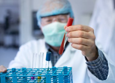 Doktorun elinin üzerinde kan olan test tüpünü tutarken yakın plan. Laboratuvarda salgın testi