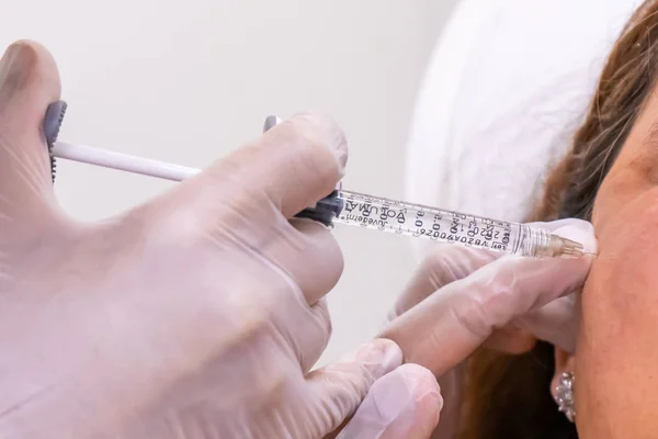 Gloved doctor hand injecting a vial of hyaluronic acid (HA) based dermal filler into patient for a non-surgical cheek and face lift. — Stock Photo, Image