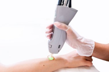 Bir kozmetoloji cilt kliniğinde, tıraş tan sonra epilasyon, güzellik teknisyeni ve kadın hasta ile kol lazer epilasyon oturumu yakın.