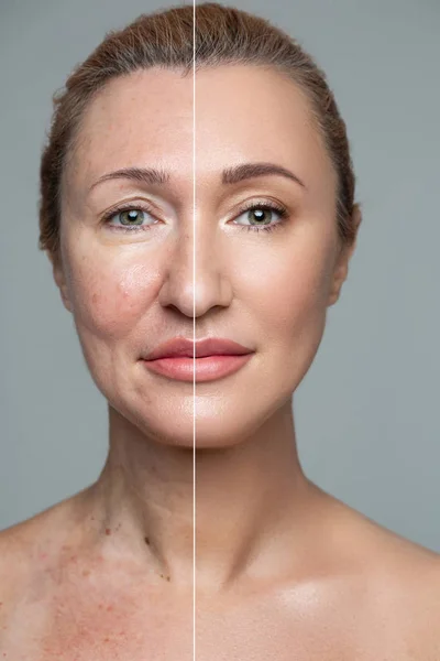 Herhangi bir yaşta bir kozmetikçiye ya da estetik cerrahına gidebilirsiniz.