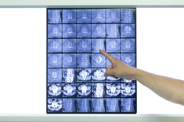 Nukleär Magnetisk Filmen Som Gjorts Sjukhuset Imaging Institutionen — Stockfoto