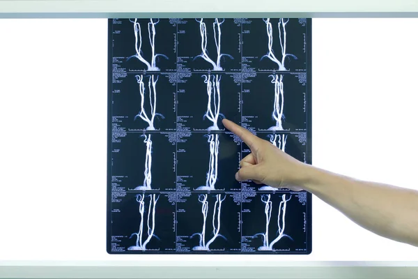 Nukleär Magnetisk Filmen Som Gjorts Sjukhuset Imaging Institutionen Stockfoto