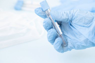 Bir laboratuvar teknisyeninin ellerinde bir tüp kan örneği, laboratuvar asistanı araştırma için kan testi tüpü tutuyor. Virüsü tanımlamak için biyolojik materyallerin alınması, grip. Boşluğu kopyala