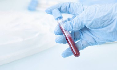 Bir laboratuvar teknisyeninin elinde bir tüp kan örneği / laboratuvar asistanı olan elleri araştırma için kan testi tüpü tutuyor. Virüsü tanımlamak için biyolojik materyallerin alınması, grip. Boşluğu kopyala