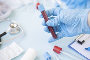 Bir doktor ya da hemşire kan testi için bir test tüpü tutuyor. Virüs ya da grip için kan örneği alan laboratuvar asistanının elleri. Virüs ve gribe karşı aşı.