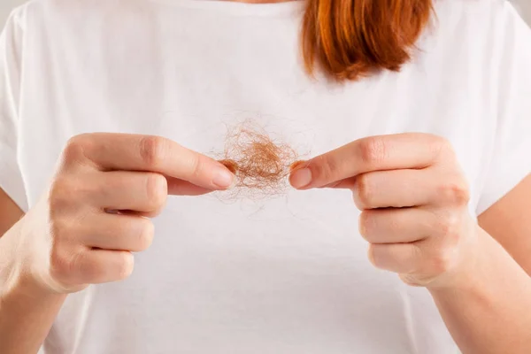 Women\'s Hair Loss.