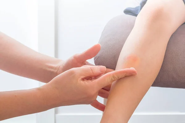 Mão Feminina Mãe Médico Colocando Gesso Ferida Hematomas Uma Perna — Fotografia de Stock