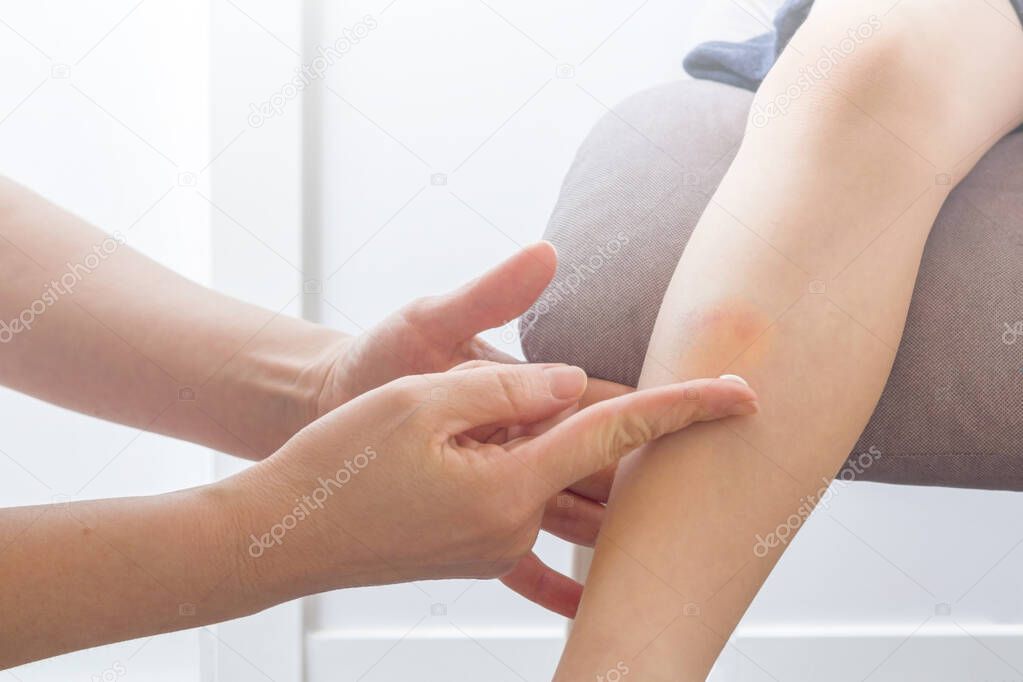 Female hand (mom or doctor) putting sticking plaster on the wound or bruise on a leg of child. Pain, hematoma, first aid. Healthcare, hildren's ambulance concept. Selective focus, backlight