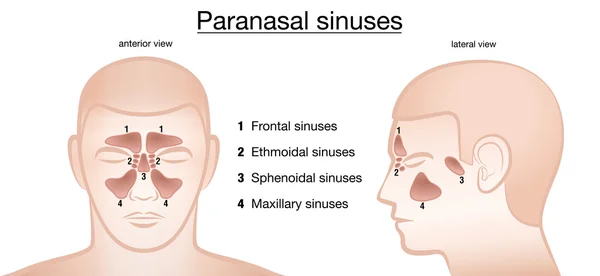 Sinusite Paranasal Lateral Anterior —  Vetores de Stock