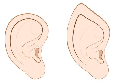 İnsan kulağının sivri kulak Elf karşılaştırma