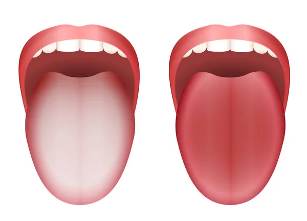 Coated Tongue Clean Tongue — Stock Vector