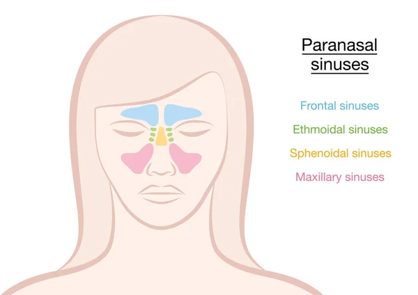 Paranasal Sinus Woman — стоковый вектор