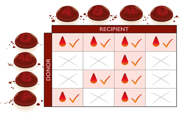 Blood groups transfusion compatibility chart with column and row for donor and recipient. Compatible fields with check marks, crossed non-compatible boxes for incompatibility.
