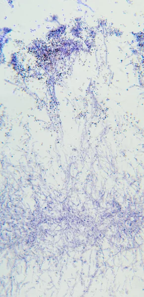 Penisilyum Ascomycetous Mantar Mikroskop Altında Detay Nsanlar Için Ascomycetes Ekmek — Stok fotoğraf