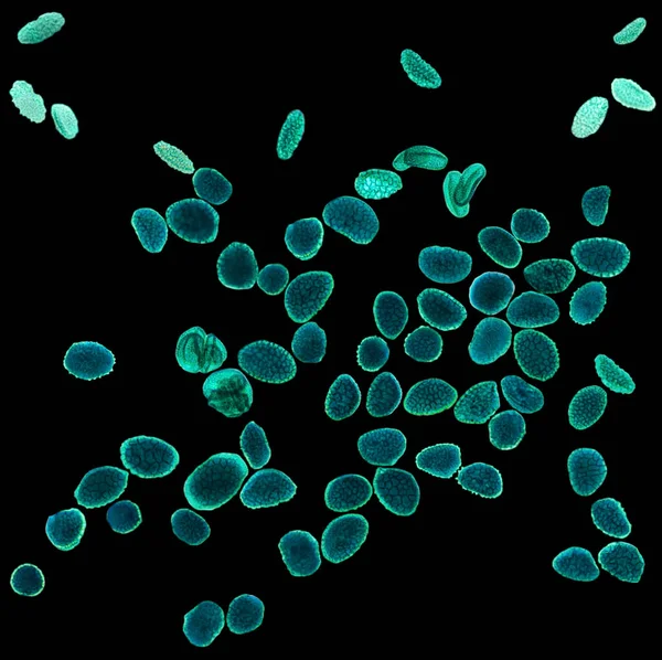 Vergrote Stuifmeelkorrels Onder Lichtmicroscoop Stuifmeelkorrels Veroorzaken Vaak Allergische Reacties Antigenen — Stockfoto