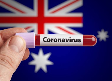 Coronavirus 'u tutan bilim adamı Avustralya bayrağı önünde test tüpünde kan bulaştırdı. Dünya konseptindeki ülkelerde salgın hastalık Covid-19.