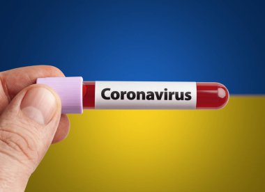 Coronavirus 'u tutan bilim adamı Ukrayna bayrağı önünde test tüpünde kan bulaştırdı. Dünya konseptindeki ülkelerde salgın hastalık Covid-19.