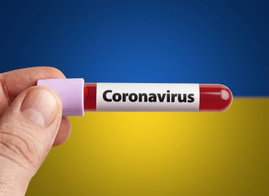 Scientist holding Coronavirus infected blood in test tube in front of Ukraine flag. Epidemic COVID-19 infection in countries in world concept. clipart