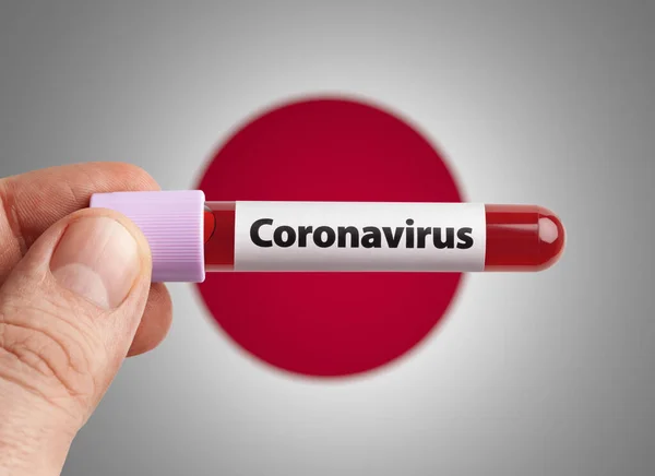 Científico Sosteniendo Sangre Infectada Con Coronavirus Tubo Ensayo Frente Bandera — Foto de Stock