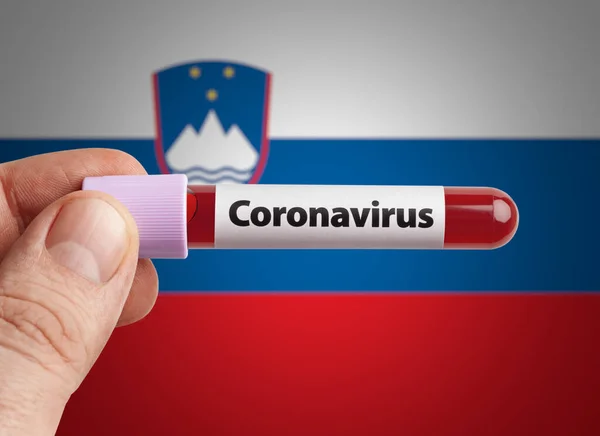 Науковець Який Тримає Коронавірус Заразив Кров Пробірці Перед Прапором Словенії — стокове фото