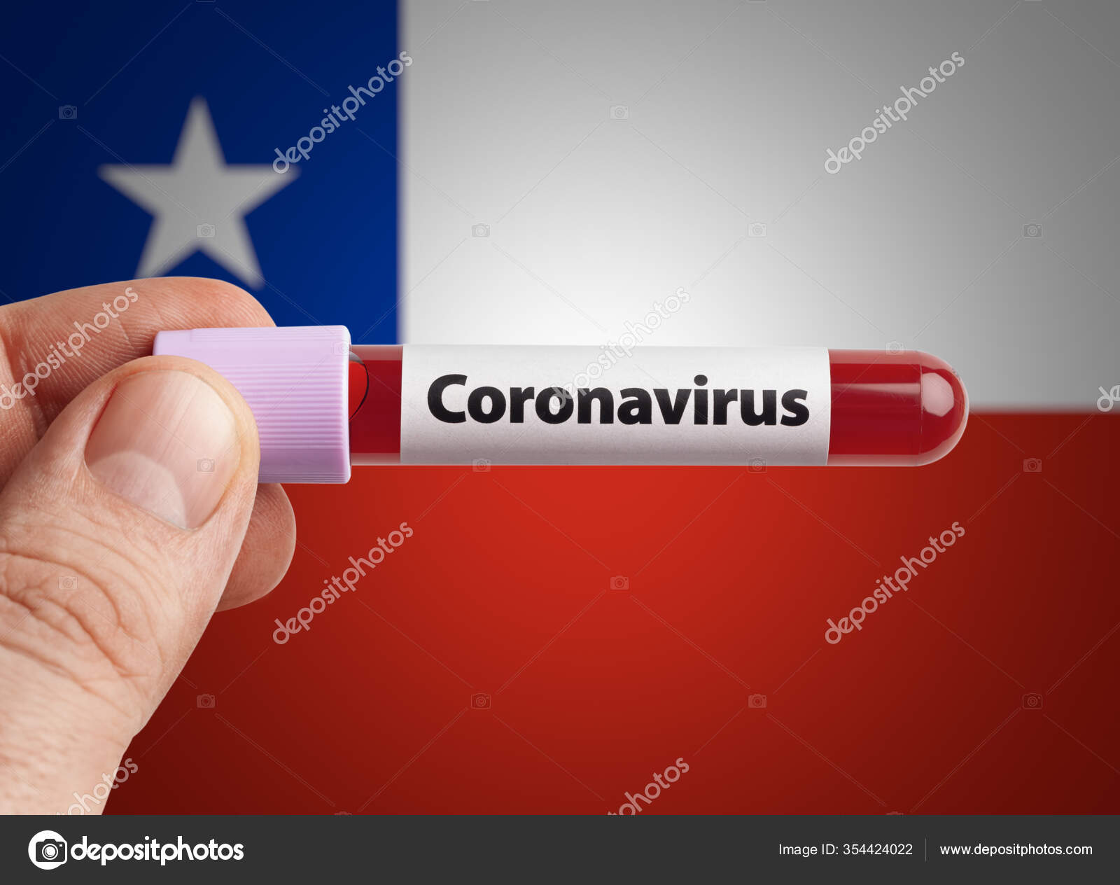 科学家在智利国旗前的试管中保存了感染了考拉韦病毒的血液世界各国流行的covid 19感染概念 图库照片 C Micrologia