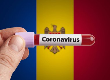 Scientist holding Coronavirus infected blood in test tube in front of Moldova flag. Pandemic COVID-19 infection in countries in world concept. clipart
