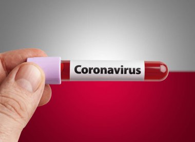 Coronavirus 'u tutan bilim adamı Polonya bayrağı önünde test tüpünde kan bulaştırdı. Dünya konseptindeki ülkelerde salgın Covid-19 enfeksiyonu.