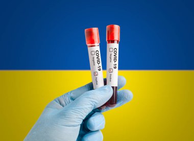 Salgın COVID-19 konsepti: Test tüplerinde kan örneği tutan bilim adamı Ukrayna bayrağı önünde pozitif test sonuçlarıyla işaretlendi.