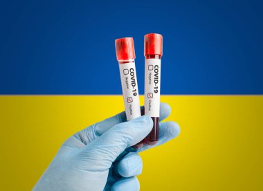 Pandemic COVID-19 concept: Scientist holding blood sample in test tubes with positive test result marked in front of Ukraine flag. clipart