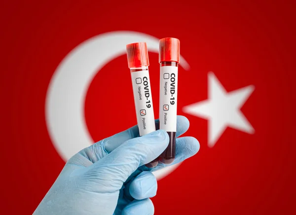 Salgın COVID-19 konsepti: Test tüplerinde kan örneği tutan bilim adamı Türkiye bayrağı önünde pozitif test sonuçlarıyla işaretlendi.